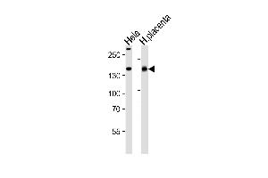 Western blot analysis of lysates from Hela cell line and human placenta tissue lysate(from left to right), using COL4A1 Antibody at 1:1000 at each lane. (COL4A1 抗体  (N-Term))