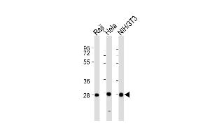 All lanes : Anti-PSMB7 Antibody (Center) at 1:2000 dilution Lane 1: Raji whole cell lysates Lane 2: Hela whole cell lysates Lane 3: NIH/3T3 whole cell lysates Lysates/proteins at 20 μg per lane.