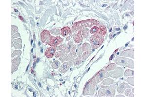 Immunohistochemistry (IHC) image for anti-Transient Receptor Potential Cation Channel, Subfamily M, Member 2 (TRPM2) (N-Term) antibody (ABIN2781840)