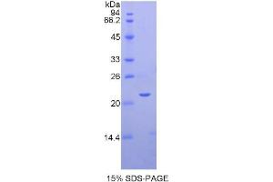 SDS-PAGE (SDS) image for Sema Domain, Immunoglobulin Domain (Ig), Short Basic Domain, Secreted, (Semaphorin) 3F (SEMA3F) (AA 604-785) protein (His tag) (ABIN1878505) (SEMA3F Protein (AA 604-785) (His tag))