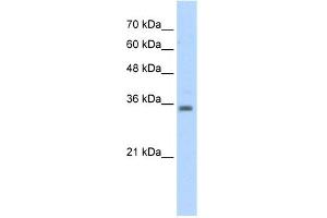 WB Suggested Anti-RASSF7 Antibody Titration:  5. (RASSF7 抗体  (Middle Region))