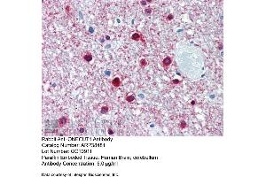 Immunohistochemistry with Human Brain, cerebellum tissue at an antibody concentration of 5. (ONECUT1 抗体  (Middle Region))