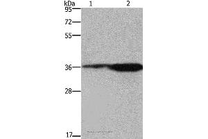 Western blot analysis of 293T cell and mouse brain tissue, using FCAR Polyclonal Antibody at dilution of 1:550 (FCAR 抗体)