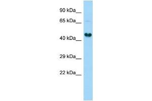 Host:  Rabbit  Target Name:  Gdap1l1  Sample Type:  Rat Kidney lysates  Antibody Dilution:  1. (GDAP1L1 抗体  (C-Term))