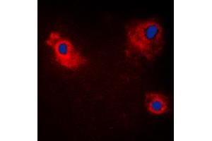 Immunofluorescent analysis of TANK staining in HeLa cells. (TANK 抗体  (Center))