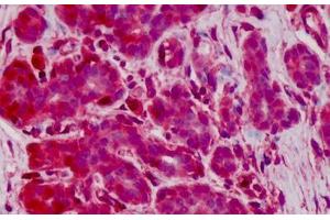 Human Breast: Formalin-Fixed, Paraffin-Embedded (FFPE) (Glutathione Peroxidase 1 抗体  (AA 127-193))