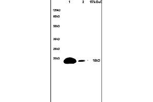 Lane 1: mouse brain lysates Lane 2: mouse heart lysates probed with Anti-phospho-BAD(Ser128) Polyclonal Antibody, Unconjugated (ABIN729478) at 1:200 in 4C. (BAD 抗体  (pSer128))