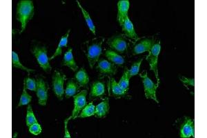 Immunofluorescent analysis of Hela cells using ABIN7144591 at dilution of 1:100 and Alexa Fluor 488-congugated AffiniPure Goat Anti-Rabbit IgG(H+L) (RARS 抗体  (AA 201-500))