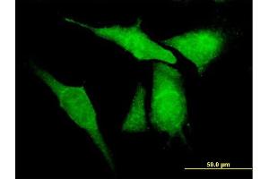 Immunofluorescence of purified MaxPab antibody to KCNIP4 on HeLa cell. (KCNIP4 抗体  (AA 1-250))