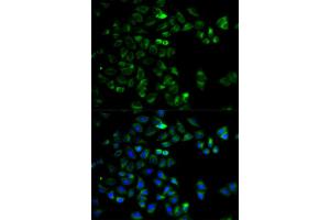 Immunofluorescence analysis of HeLa cells using HTRA2 antibody (ABIN5973384). (HTRA2 抗体)
