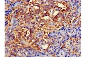 Immunohistochemistry of paraffin-embedded human pancreatic tissue using ABIN7145827 at dilution of 1:100 (TNFAIP1 抗体  (AA 233-316))