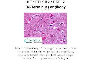 Image no. 2 for anti-Cadherin EGF LAG Seven Pass G-Type Receptor 2 (CELSR2) (Extracellular Domain), (N-Term) antibody (ABIN1732970) (CELSR2 抗体  (Extracellular Domain, N-Term))