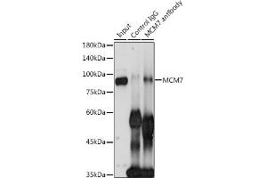 Immunoprecipitation analysis of 300 μg extracts of HeLa cells using 3 μg MCM7 antibody (ABIN3021520, ABIN3021521, ABIN3021522 and ABIN6215189). (MCM7 抗体  (AA 360-719))