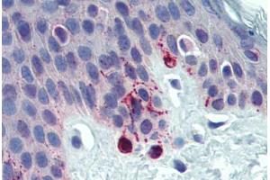 Skin, Human: Formalin-Fixed, Paraffin-Embedded (FFPE) (Tyrosinase-Related Protein 1 抗体  (AA 396-445))