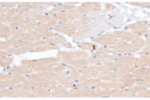 Immunohistochemistry of paraffin-embedded Rat heart using ABCB7 Polyclonal Antibody at dilution of 1:100 (40x lens). (ABCB7 抗体)
