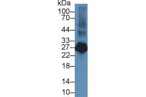 Western Blot; Sample: Rat Spleen lysate; Primary Ab: 2µg/ml Rabbit Anti-Rat LAT2 Antibody Second Ab: 0. (LAT2 抗体  (AA 32-192))