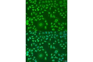 Immunofluorescence analysis of U2OS cells using  antibody (ABIN7265477) at dilution of 1:100. (ARL6 抗体  (AA 1-186))
