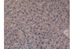 Detection of MEP1b in Rat Liver Tissue using Polyclonal Antibody to Meprin A Beta (MEP1b) (Meprin B 抗体  (AA 433-679))
