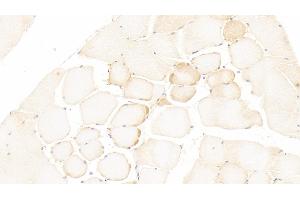 Detection of LOX in Human Skeletal muscle Tissue using Polyclonal Antibody to Lysyl Oxidase (LOX) (LOX 抗体  (AA 213-417))