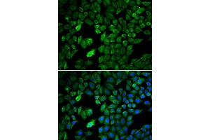 Immunofluorescence analysis of U2OS cells using PRMT5 antibody. (PRMT5 抗体)