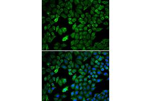 Immunofluorescence analysis of U2OS cells using PRMT5 antibody. (PRMT5 抗体)