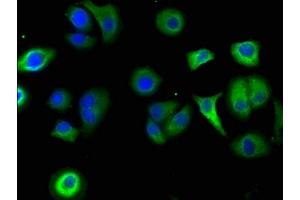 Immunofluorescence staining of A549 cells with ABIN7169172 at 1:50, counter-stained with DAPI. (Sbk2 抗体  (AA 62-330))