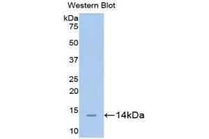 Western Blotting (WB) image for anti-Carcinoembryonic Antigen-Related Cell Adhesion Molecule 1 (CEACAM1) (AA 35-143) antibody (ABIN1175886) (CEACAM1 抗体  (AA 35-143))