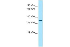 WB Suggested Anti-Atf5 Antibody Titration: 1. (ATF5 抗体  (C-Term))