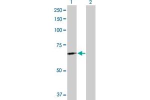 Western Blot analysis of FGL2 expression in transfected 293T cell line by FGL2 MaxPab polyclonal antibody. (FGL2 抗体  (AA 1-439))