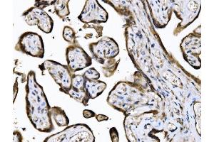 IHC analysis of KIF2A using anti-KIF2A antibody (ABIN7600510). (KIF2A 抗体  (AA 2-706))