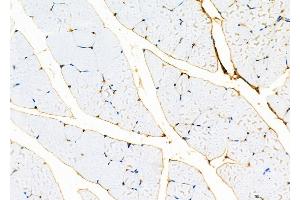 ABIN6260177 and ABIN6279188 at 1/100 staining Mouse muscle tissue by IHC-P.