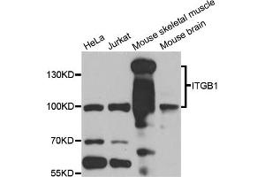 Western blot analysis of extracts of various cell lines, using ITGB1 antibody (ABIN6003513) at 1/1000 dilution. (ITGB1 抗体)