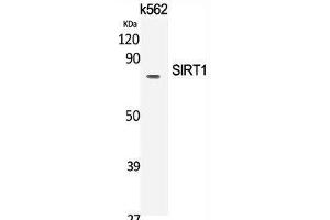 Western Blot analysis of K562 cells using SIRT1 Polyclonal Antibody at dilution of 1:2000. (SIRT1 抗体)