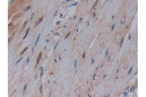 Detection of COX-1 in Human Rectum Tissue using Polyclonal Antibody to Cyclooxygenase 1 (COX-1) (COX-1 抗体  (AA 367-599))