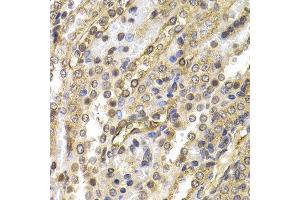 Immunohistochemistry (IHC) image for anti-Neural Precursor Cell Expressed, Developmentally Down-Regulated 9 (NEDD9) (AA 60-174) antibody (ABIN3023331) (NEDD9 抗体  (AA 60-174))