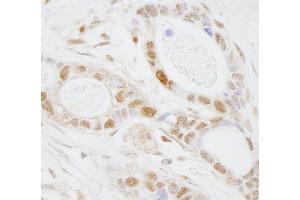 Immunohistochemistry (IHC) image for anti-Pseudouridylate Synthase 1 (PUS1) (AA 377-427) antibody (ABIN7448747) (PUS1 抗体  (AA 377-427))