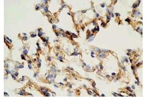 Rat lung tissue was stained by Rabbit Anti-AdrenomeduIIiln (1-44) (Human) Antibody (Adrenomedullin 抗体  (AA 1-44))