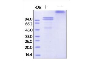 The purity of rhECAD Fc Chimera was determined by SDS-PAGE of reduced (R) and non-reduced (NR) rhECAD Fc Chimera and staining overnight with Coomassie Blue. (E-cadherin Protein (AA 23-621) (Fc Tag))