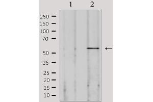 Western blot analysis of extracts from 293, using SPAM1 Antibody. (SPAM1 抗体  (Internal Region))