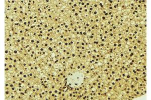ABIN6277003 at 1/100 staining Mouse liver tissue by IHC-P. (OGT 抗体  (N-Term))