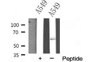Western blot analysis of FAST kinase expression in A549 cells (FASTK 抗体  (Internal Region))