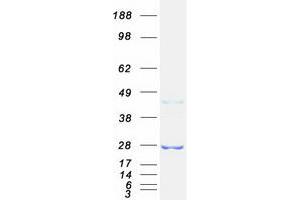 Western Blotting (WB) image for RAB32, Member RAS Oncogene Family (RAB32) protein (Myc-DYKDDDDK Tag) (ABIN2730327)