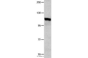 Western blot analysis of K652 cell , using IDE Polyclonal Antibody at dilution of 1:350 (IDE 抗体)