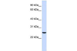 WB Suggested Anti-UBE2K Antibody Titration: 0. (UBE2K 抗体  (Middle Region))