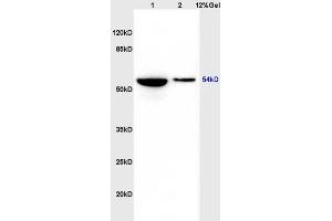 Lane 1: rat heart lysates Lane 2: rat brain lysates probed with Anti phospho-GSK3 Alpha(Ser21) Polyclonal Antibody, Unconjugated (ABIN708116) at 1:200 in 4 °C. (GSK3 alpha 抗体  (pSer21))