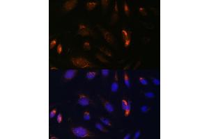 Immunofluorescence analysis of U-2 OS cells using CHUK antibody (ABIN3022824, ABIN3022825, ABIN3022826 and ABIN6219246) at dilution of 1:100. (IKK alpha 抗体  (C-Term))