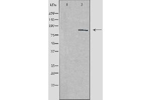 Western blot analysis of extracts from HepG2 cells, using ZNF148 antibody.