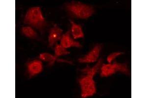 ABIN6267221 staining HeLa by IF/ICC. (CHEK1 抗体  (pSer296))
