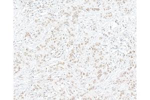 Immunohistochemistry (IHC) image for anti-Enhancer of Zeste Homolog 2 (EZH2) (C-Term) antibody (ABIN7795724)