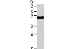 Western Blot analysis of Human breast infiltRative duct tissue using RHCE Polyclonal Antibody at dilution of 1/250 (RHCE 抗体)